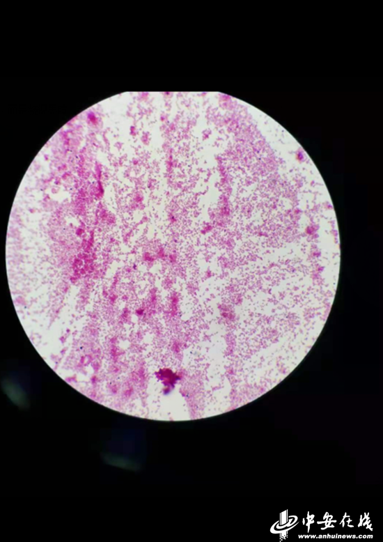 显微镜下观察西瓜菌落总数