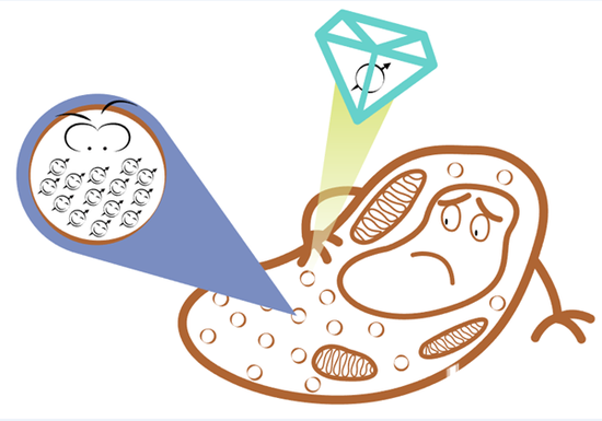 “钻石传感器”检测原位细胞铁蛋白中的铁离子