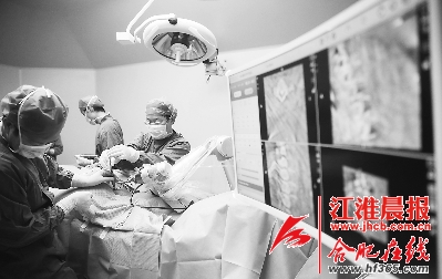 中国造骨科手术机器人合肥首秀