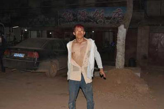 买卖不成仁义丢!男子碰瓷不成改抢劫