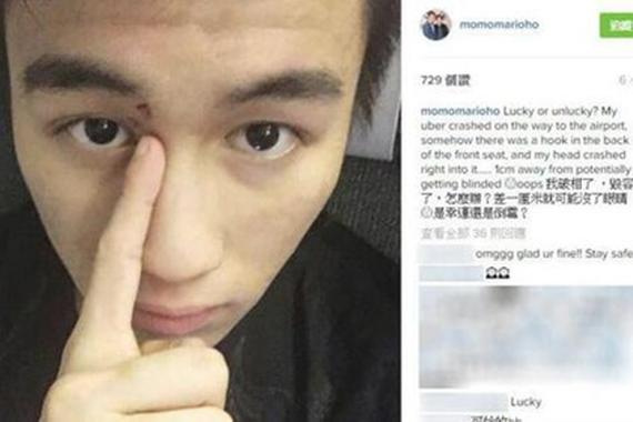 赌王儿子何猷君遇车祸：差1cm可能没了眼睛