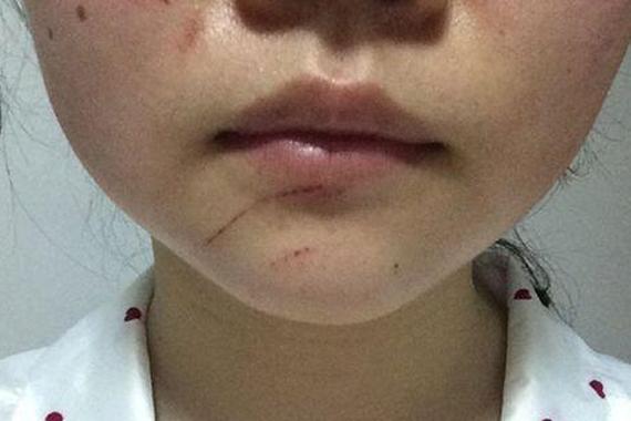 女子在医院停车场遭假警察电击棒殴打