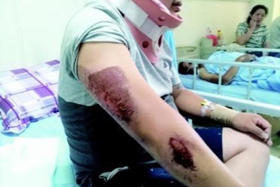 车主去4S店被抢走12万 家人遭拖行数十米