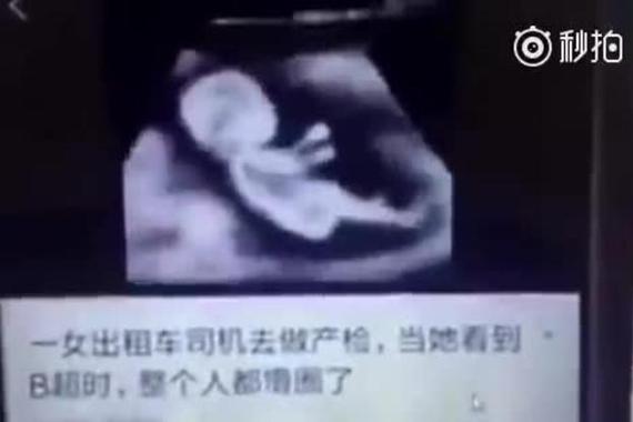 视频：女出租司机做产检 结果惊呆了！