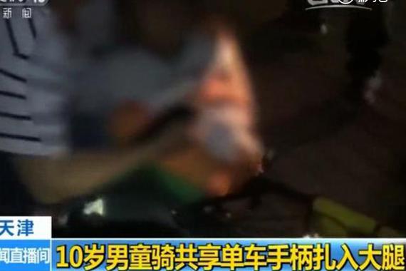 视频：10岁男童骑共享单车 手柄扎入大腿