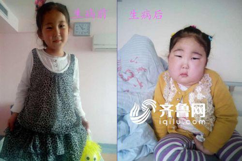 1609c764ac4f0b2db2dba1c3974723ff.jpg 对比照