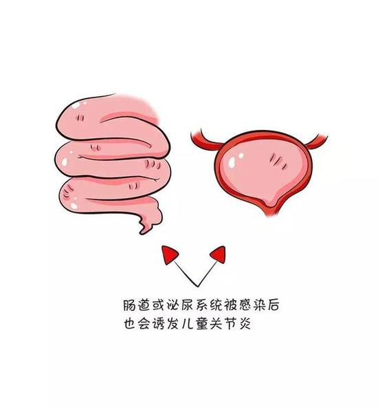 春季宝宝长个的黄金期呢,别被儿童关节炎忽悠了