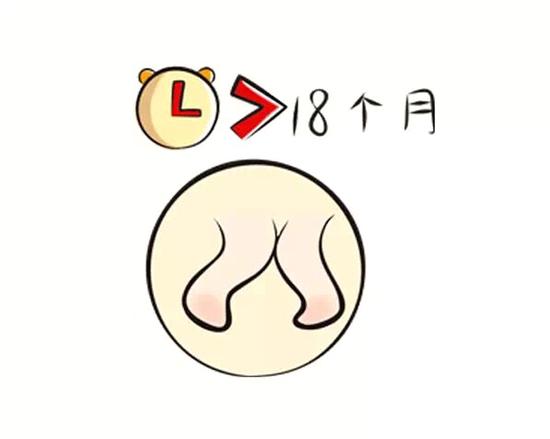 囟门闭合的时间,是衡量宝颅骨发育的重要指标