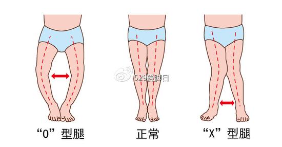 如何给宝宝脚丫做个全面检查|脚丫|足部|儿童鞋