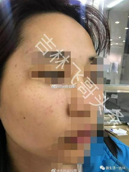 图片来源:吉林飞哥头条微博
