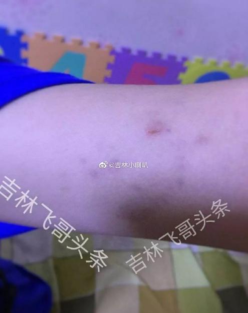图片来源:吉林飞哥头条微博
