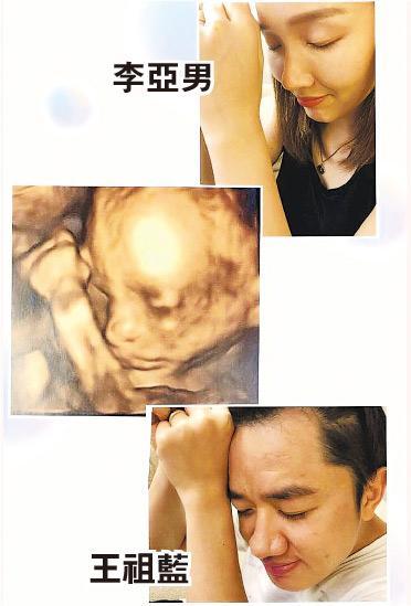 从超声波照片所见，小宝宝的鼻、唇及额头跟王祖蓝很相似，不知道有没有遗传妈妈李亚男的长腿？