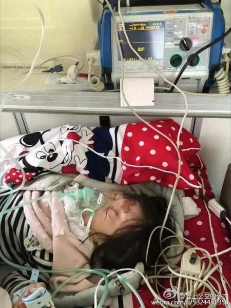 三岁女孩昏迷被送往医院抢救