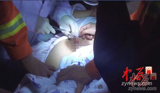 男童尿尿下体被拉链夹 消防2分钟成功破拆