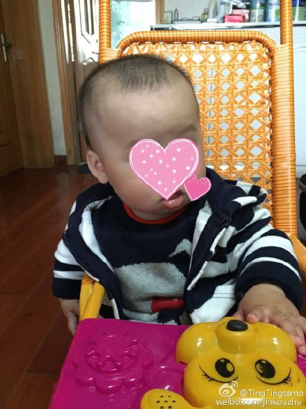 看一下宝宝是不是方颅?(图)|张思莱|方颅|缺钙