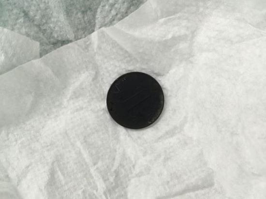 图说：取出的硬币已被胃酸腐蚀成黑色。松江区中心医院供图