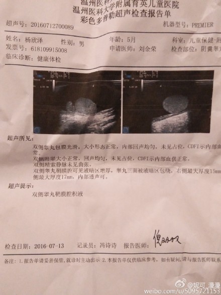 宝宝阴囊不一样大有问题吗?|鲍秀兰|阴囊积液_新浪育儿_新浪网