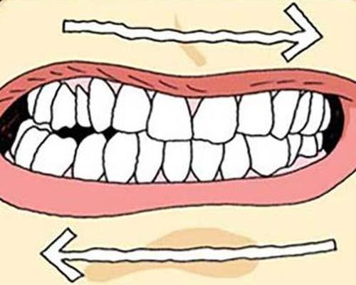 夜间磨牙 都是蛔虫惹的祸？