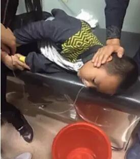 在刘鑫泽的呕吐物中,有明显的一大段铅笔芯颗粒,家人赶紧把他送到大庆油田总医院。