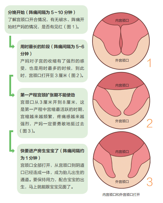 依宫颈口扩张情况进行分娩