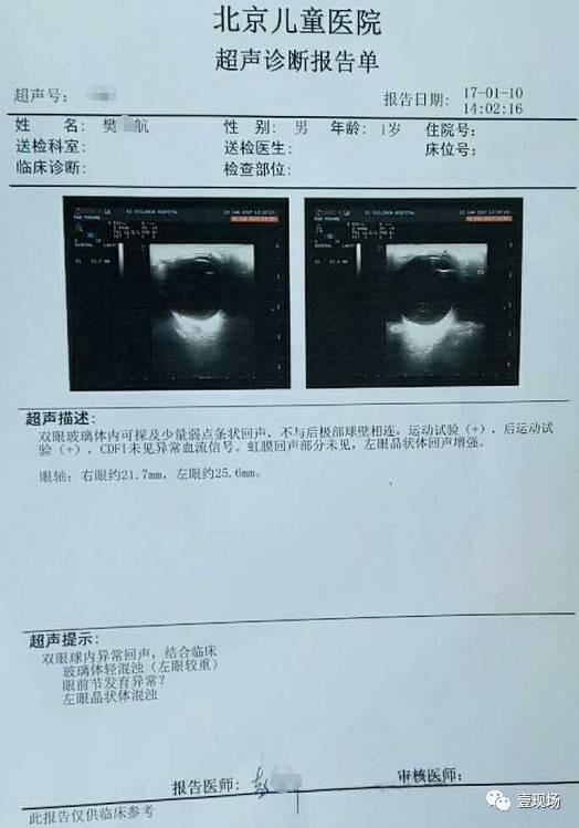 北京儿童医院超声诊断报告单