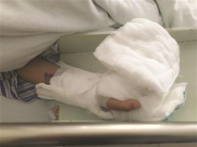 孩子目前仍在医院治疗。图片为医院提供