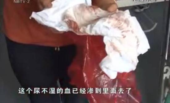 女婴染血的尿不湿及衣物