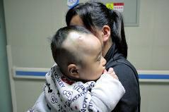 4个月男婴医院打吊针 胶布粘掉娃头皮