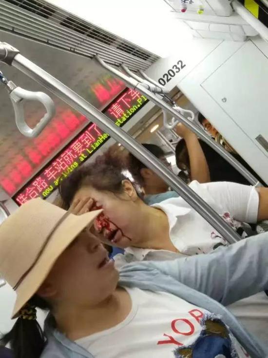 女子被砸流血