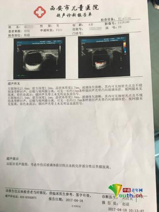 被虐待男童鹏鹏四月份病院超声诊断申报单。 @呼唤鹏鹏 图