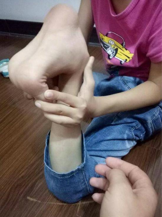 男孩关节可随便率性曲折