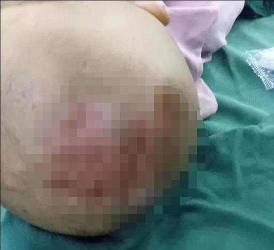 3岁女童全身是伤