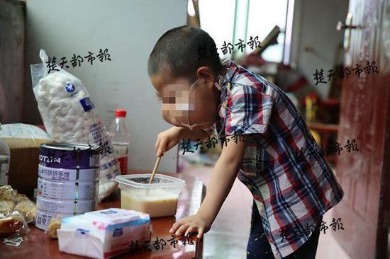 小佳欣靠流食维持生命