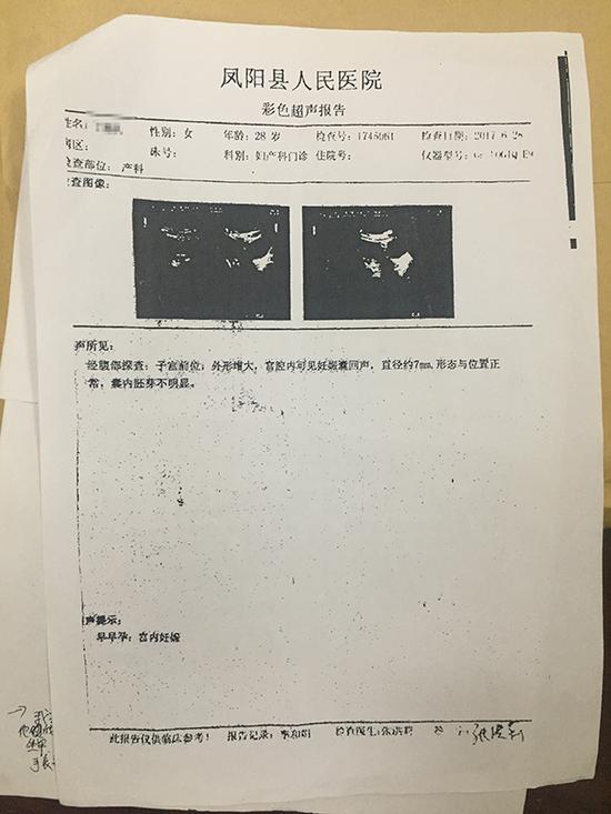 伪造的凤阳县人民医院B超单。本文图均为 警方供图