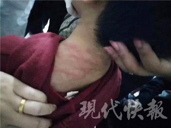 盐城一8岁女孩遭继母殴打。 警方已立案查询拜访 网友供图