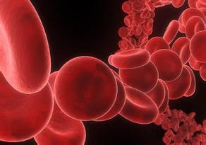 发现一例罕见RhD变异血型引起的新生儿溶血病