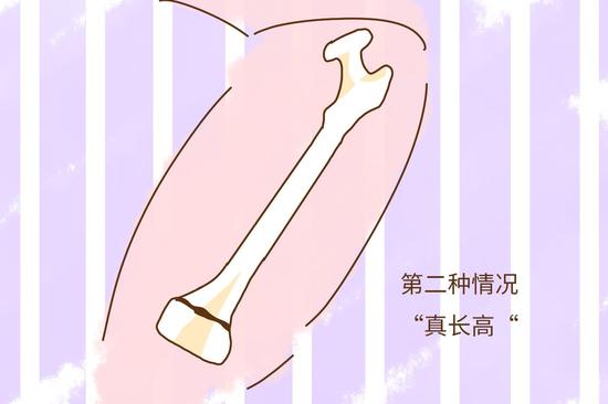 一个孕妈经历过,专家是这样解释的|怀孕|身高|骨骺线