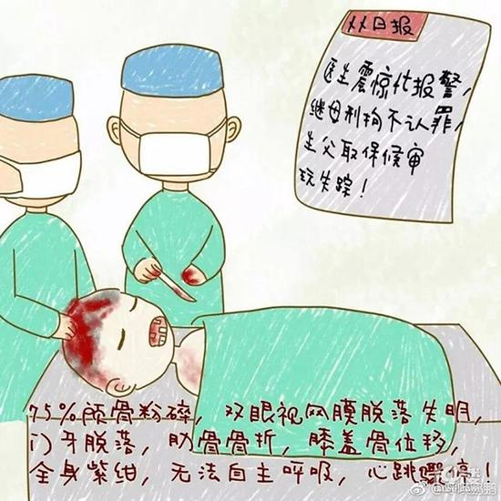 鹏鹏手术