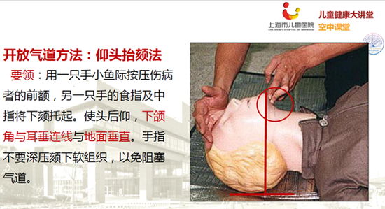 海姆立克急救法