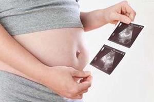 孕中期心律失常 射频消融解忧