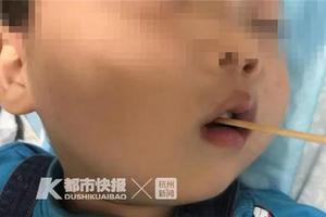 3宀佺敺瀛╄绔圭浠庡槾宸存彃鑴戝共 杩欎笢瑗垮緢澶氬瀛愮埍鍚�