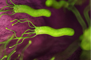 一人感染 全家中招！幽门螺旋杆菌到底是何方“妖孽”？