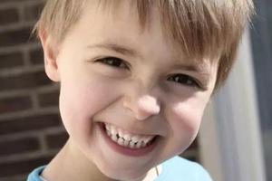 几岁是牙齿正畸的最好时机？