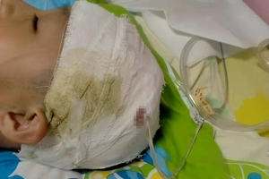 河南西华营镇中心学校学生被打头后病发