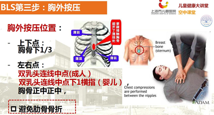 海姆立克急救法