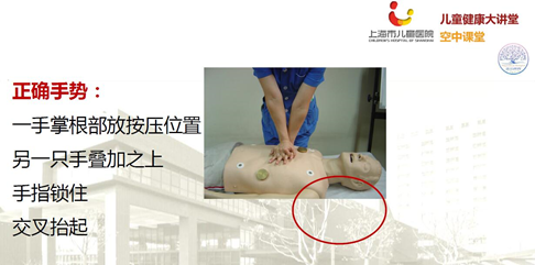 海姆立克急救法