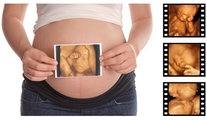 孕妇B超私下验男女胎儿受损风险大？