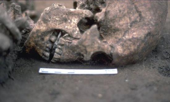 英国考古学家发现一具令人惊骇的男性尸骨，他的舌头被人割下后再塞进石头。（英国《卫报》）