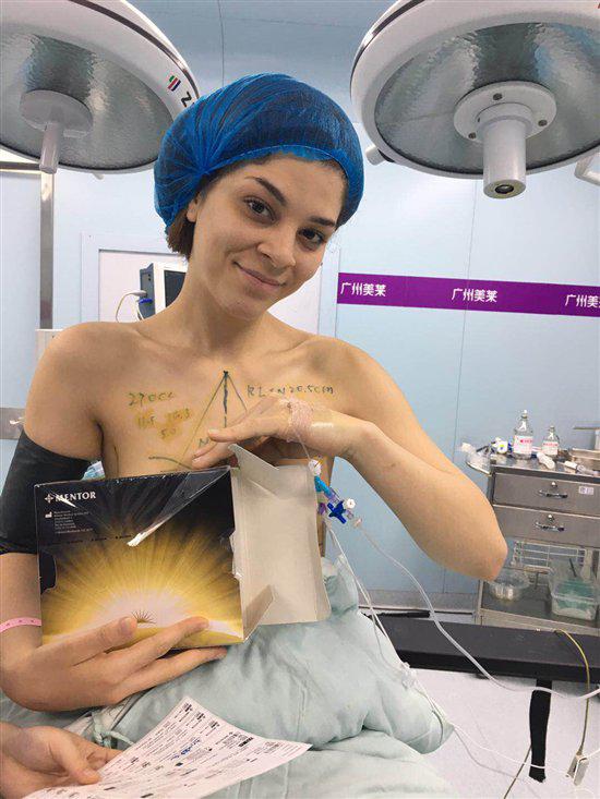 (手术室的Isa(伊莎)开心地向着镜头展示即将植入体内的强生曼托假体)