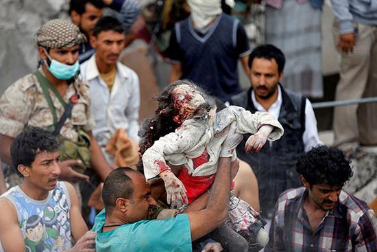 当地时间2017年8月25日，也门萨那，医疗人员举着一名在空袭中受伤的孩子。